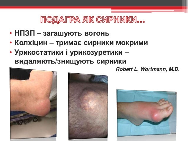 Симптомы стертых колодок
