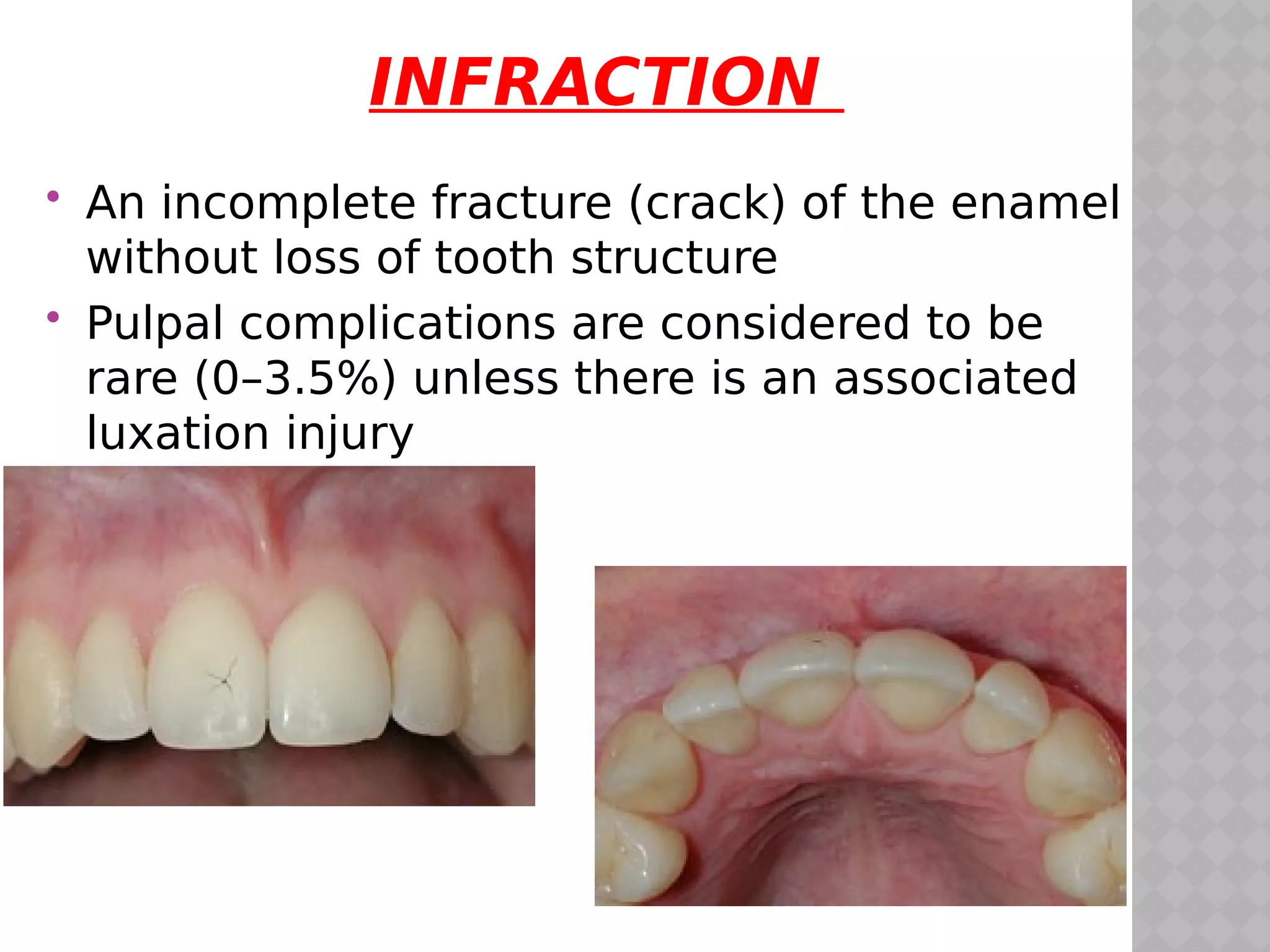 traumatic injuries to teeth | PDF