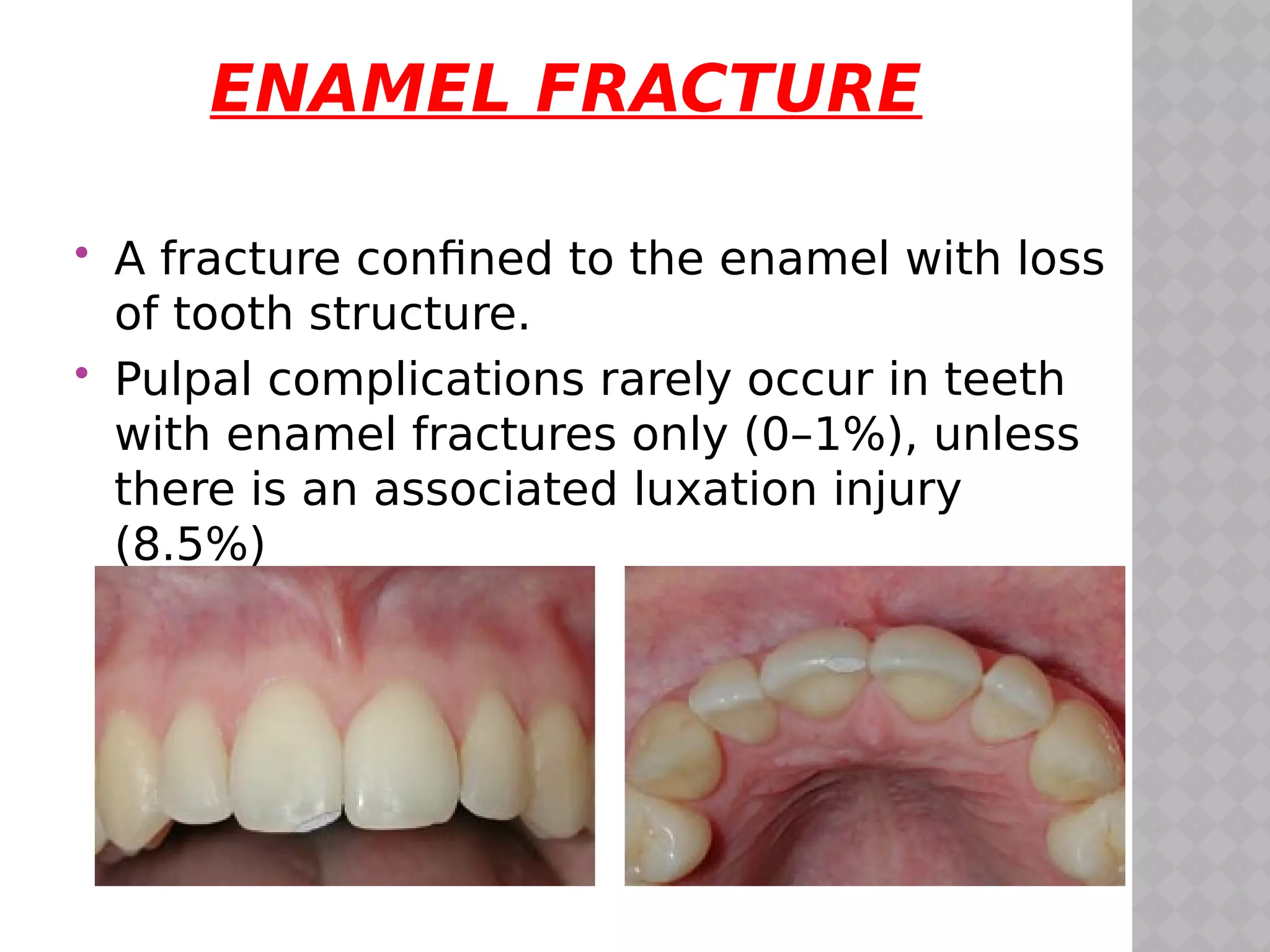 traumatic injuries to teeth | PDF
