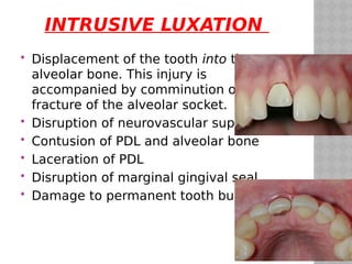 traumatic injuries to teeth | PDF