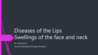 Diseases of the Lips
Swellings of the face and neck
Dr. Hadi Munib
Oral and Maxillofacial Surgery Resident
 