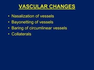 VASCULAR CHANGES
• Nasalization of vessels
• Bayonetting of vessels
• Baring of circumlinear vessels
• Collaterals
 
