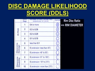 DISC DAMAGE LIKELIHOOD
SCORE (DDLS)
 