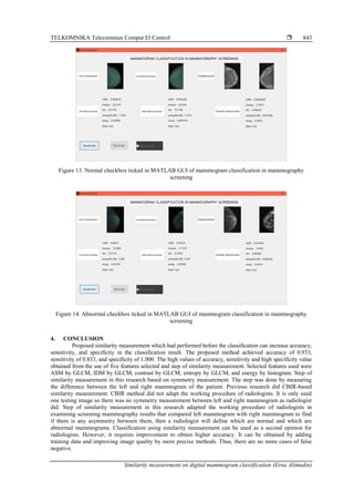TELKOMNIKA Telecommun Comput El Control 
Similarity measurement on digital mammogram classification (Erna Alimudin)
843
Figure 13. Normal checkbox ticked in MATLAB GUI of mammogram classification in mammography
screening
Figure 14. Abnormal checkbox ticked in MATLAB GUI of mammogram classification in mammography
screening
4. CONCLUSION
Proposed similarity measurement which had performed before the classification can increase accuracy,
sensitivity, and specificity in the classification result. The proposed method achieved accuracy of 0.933,
sensitivity of 0.833, and specificity of 1.000. The high values of accuracy, sensitivity and high specificity value
obtained from the use of five features selected and step of similarity measurement. Selected features used were
ASM by GLCM, IDM by GLCM, contrast by GLCM, entropy by GLCM, and energy by histogram. Step of
similarity measurement in this research based on symmetry measurement. The step was done by measuring
the difference between the left and right mammogram of the patient. Previous research did CBIR-based
similarity measurement. CBIR method did not adapt the working procedure of radiologists. It is only used
one testing image so there was no symmetry measurement between left and right mammogram as radiologist
did. Step of similarity measurement in this research adapted the working procedure of radiologists in
examining screening mammography results that compared left mammogram with right mammogram to find
if there is any asymmetry between them, then a radiologist will define which are normal and which are
abnormal mammograms. Classification using similarity measurement can be used as a second opinion for
radiologists. However, it requires improvement to obtain higher accuracy. It can be obtained by adding
training data and improving image quality by more precise methods. Thus, there are no more cases of false
negative.
 