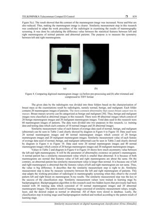 TELKOMNIKA Telecommun Comput El Control 
Similarity measurement on digital mammogram classification (Erna Alimudin)
839
Figure 5(c). The result showed that the contrast of the mammogram image was increased. Noise and blur are
also reduced. Thus, making the mammogram image is clearer. Similarity measurement step in this research
was conducted to adapt the work procedure of the radiologist in examining the results of mammography
screening. It was done by calculating the difference value between the statistical features between left and
right mammograms of normal patients and abnormal patients. The purpose is to measure the symmetry
between left and right mammograms.
(a) (b)
Figure 4. Comparing digitized mammogram image: (a) before pre-processing and (b) after trimmed and
compressed to TIFF format
The given data by the radiologists was divided into three folders based on the characterization of
breast mass as the examinations result by radiologists, namely normal, benign, and malignant. Each folder
contains 20 mammogram images of patients. The most common abnormality that causes breast cancer was its
masses. Breast masses severity can be categorized as benign and malignant [30]. Thus, benign and malignant
images were classified as abnormal images in this research. There were 40 abnormal images which consist of
20 benign mammogram images and 20 malignant mammogram images. Total data used in this research were
60 mammogram images of patients. The data were divided into two purposes in this research, i.e. training
data and testing data which each contains of 10 normal images and 20 abnormal images.
Similarity measurement value of each feature of average data used of normal, benign, and malignant
(abnormal) can be seen in Table 2 and clearly showed by diagram in Figure 6 to Figure 10. Data used were
20 normal mammogram images and 40 normal mammogram images which consist of 20 benign
mammogram images and 20 malignant mammogram images. Similarity measurement value of each feature
of average data used of normal, benign, and malignant (abnormal) can be seen in Table 2 and clearly showed
by diagram in Figure 6 to Figure 10. Data used were 20 normal mammogram images and 40 normal
mammogram images which consist of 20 benign mammogram images and 20 malignant mammogram images.
Values in Table 2 and diagram in Figure 6 to Figure 10 shows how much asymmetry value between
the left and right mammograms. It will be the parameter of abnormality existence on patient’s mammogram.
A normal patient has a similarity measurement value which is smaller than abnormal. It is because of both
mammograms are normal that features value of left and right mammograms are about the same. On the
contrary, an abnormal patient has similarity measurement value is larger than normal. It is because one of left
and right mammogram is abnormal that the features values of left and right mammogram are not same. Thus,
the value is big difference. It describes that the similarity measurement step is right to do. Similarity
measurement step is done by measure symmetry between the left and right mammogram of patients. This
step adapts the working procedure of radiologist in mammography screening when they observe the overall
pattern left and right breast on mammogram X-ray results. The similarity measurement step was the key to
the success of the classification step. Similarity measurement values were trained in learning stage by
backpropagation. Backpropagation algorithm in this research used two hidden layers that previously had been
trained with 30 training data which consisted of 10 normal mammogram images and 20 abnormal
mammogram images. The pattern result of learning stage consisted of similarity measurement values, weight,
layer, and the desired output as normal or abnormal. All of them were stored in database. Lastly, the
classification step in testing stage used backpropagation method and worked according to the pattern result of
learning stage.
 