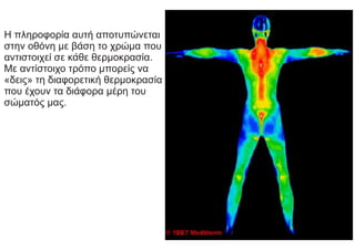 Η πληροφορία αυτή αποτυπώνεται
στην οθόνη με βάση το χρώμα που
αντιστοιχεί σε κάθε θερμοκρασία.
Με αντίστοιχο τρόπο μπορείς να
«δεις» τη διαφορετική θερμοκρασία
που έχουν τα διάφορα μέρη του
σώματός μας.
 