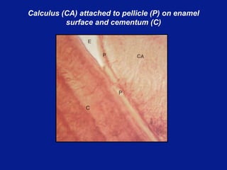 16.Role of dental calculus.ppt