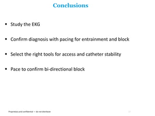 16. Atrial Flutter.pptx
