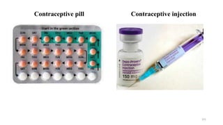 131
Contraceptive pill Contraceptive injection
 