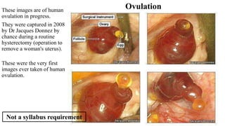 These images are of human
ovulation in progress.
They were captured in 2008
by Dr Jacques Donnez by
chance during a routine
hysterectomy (operation to
remove a woman's uterus).
These were the very first
images ever taken of human
ovulation.
37
Ovulation
Not a syllabus requirement
 