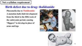 71
Birth defect due to drug: thalidomide
Phocomelia due to Thalidomide:
A mutation halts limb development
from the third to the fifth week of
the embryonic period, causing
“flippers” to develop in place of
arms and legs
 