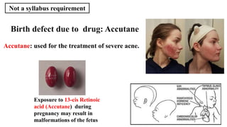 72
Accutane: used for the treatment of severe acne.
Birth defect due to drug: Accutane
Exposure to 13-cis Retinoic
acid (Accutane) during
pregnancy may result in
malformations of the fetus
Not a syllabus requirement
 