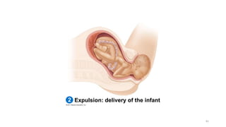 Expulsion: delivery of the infant
2
81
 