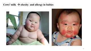 Cows’ milk  obesity and allergy in babies
93
 
