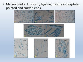 16.fusarium wilt of cotton lantril det.pdf