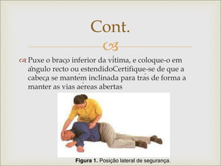 
 Puxe o braço inferior da vítima, e coloque-o em
ângulo recto ou estendidoCertifique-se de que a
cabeça se mantém inclinada para trás de forma a
manter as vias aéreas abertas
Cont.
 