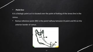 17
• Point Eva-
It is a biologic point as it is located over the point of forking of the stress line in the
ramus.
• Ramus reference point (RR) is the point halfway between Xi point and R3 on the
anterior border of ramus.
 