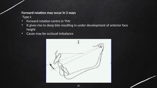 26
Forward rotation may occur in 3 ways
Type I:
• Forward rotation centre in TMJ
• It gives rise to deep bite resulting in under development of anterior face
height
• Cause may be occlusal imbalance
 