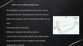 31
• The symphysis is swung backward and the chin is drawn
back below the face. The soft tissues of the chin may not
follow this movement, and a characteristic double chin can
form.
• Basal open-bite may develop,
• Difficulty in closing the lips without tension.
• Lower incisors, functionally related to the upper incisors,
become retroclined in the mandible and the alveolar
prognathism is reduced
TYPE 2: Centre at distal occluding molars
 
