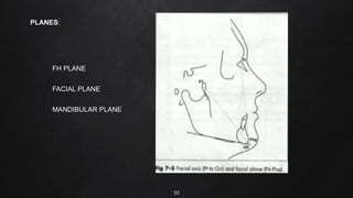 50
PLANES:
FH PLANE
FACIAL PLANE
MANDIBULAR PLANE
 