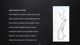 57
Lower incisor to A-Poq:
The A-Pog line or plane is referred to as the
denture plane and is a useful referance line
from which to measure the position of the
interior teeth. Ideally the lower incisor
should be located 1.0 mm ahead of the A-
Pog line. This measurement is used to
define the protrusion of the lower arch.
 