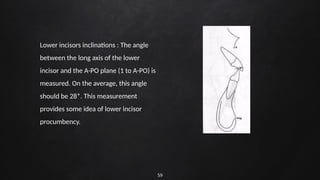 59
Lower incisors inclinations : The angle
between the long axis of the lower
incisor and the A-PO plane (1 to A-PO) is
measured. On the average, this angle
should be 28*. This measurement
provides some idea of lower incisor
procumbency.
 