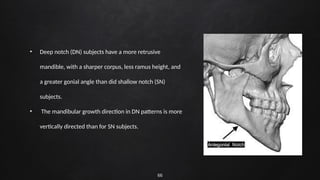 66
• Deep notch (DN) subjects have a more retrusive
mandible, with a sharper corpus, less ramus height, and
a greater gonial angle than did shallow notch (SN)
subjects.
• The mandibular growth direction in DN patterns is more
vertically directed than for SN subjects.
 