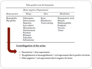 Centrifugation of the urine
 Haematuria = clear supernatant
 Myoglobinuria or haemoglobinuria = red supernatant that is positive for heme
 Other pigment = red supernatant that is negative for heme
 