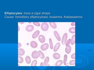 16 anemia-laboratory diagnosis | PPT