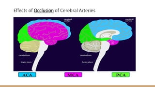 Effects of Occlusion of Cerebral Arteries
 