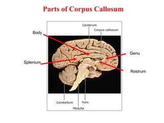 16-Cerebral Hemisphere .pdf666⁶6666666666666 | PPT