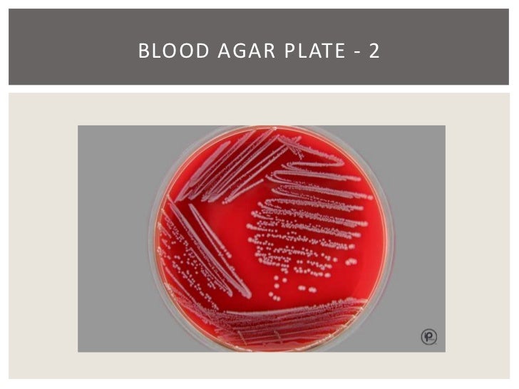 24 hours test blood 16 enterobacteriaceae chapter  19