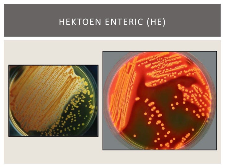 composition of xld agar chapter 16 enterobacteriaceae   19