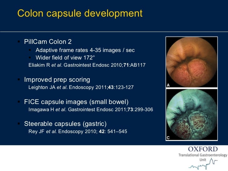 Endoscopy in Gastrointestinal Oncology Slide 16 J. East Colonos…