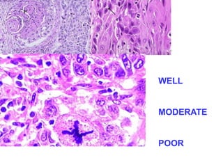 WELL 
MODERATE 
POOR 
 