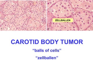 ZELLBALLEN 
CAROTID BODY TUMOR 
“balls of cells” 
“zellballen” 
 