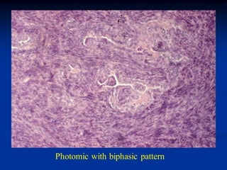 Photomic with biphasic pattern
 