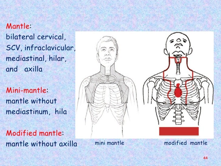 Hodgkin’s Lymphoma