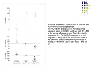 Individual and median values of thyroid function tests
in patients with various grades of
hypothyroidism. Discontinuous horizontal lines
represent upper limit (TSH) and lower limit (FT4,T3)
of the normal reference ranges. Reproduced with
permission from Ord WM: On myxedema, a term
proposed to be applied to an essential condition in
the "cretinoid" affection occasionally observed in
middle-aged women. Medico-Chir Trans 1878; 61:
57.
 