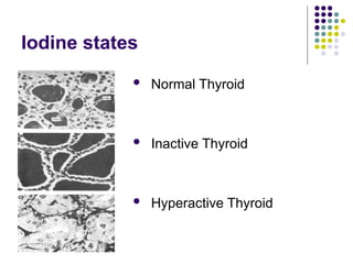 Iodine states
 Normal Thyroid
 Inactive Thyroid
 Hyperactive Thyroid
 
