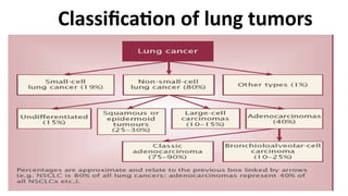 Comprehensive Overview of Lung Tumors: Types, Pathophysiology, and ...