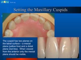 16.occlusal schemes lingualized occlusion | PPT