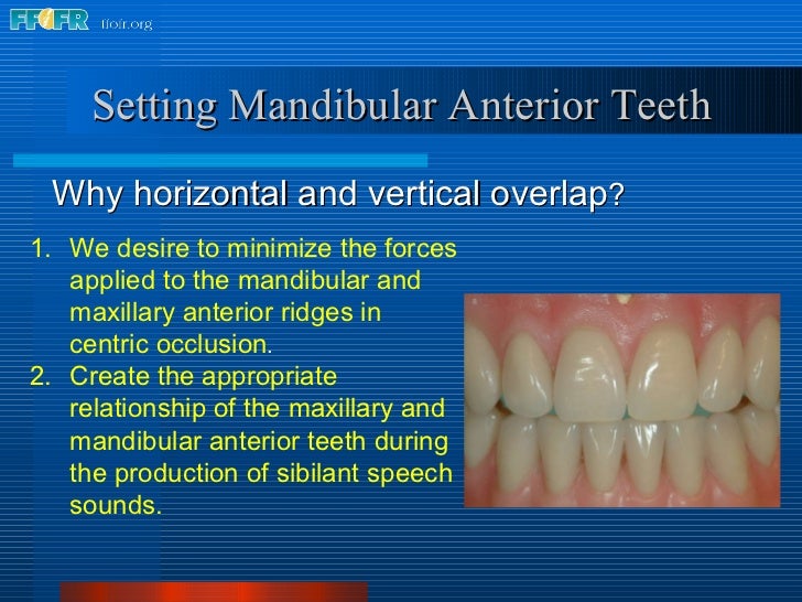16.occlusal schemes lingualized occlusion