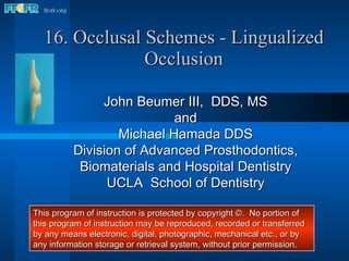 16. Occlusal Schemes - Lingualized Occlusion John Beumer III,  DDS, MS and Michael Hamada DDS Division of Advanced Prosthodontics, Biomaterials and Hospital Dentistry UCLA  School of Dentistry This program of instruction is protected by copyright ©.  No portion of this program of instruction may be reproduced, recorded or transferred by any means electronic, digital, photographic, mechanical etc., or by any information storage or retrieval system, without prior permission. 