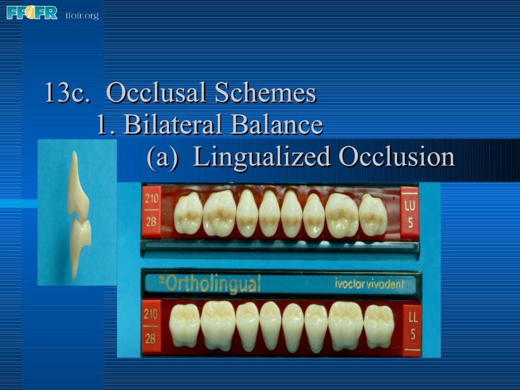 16.occlusal schemes lingualized occlusion