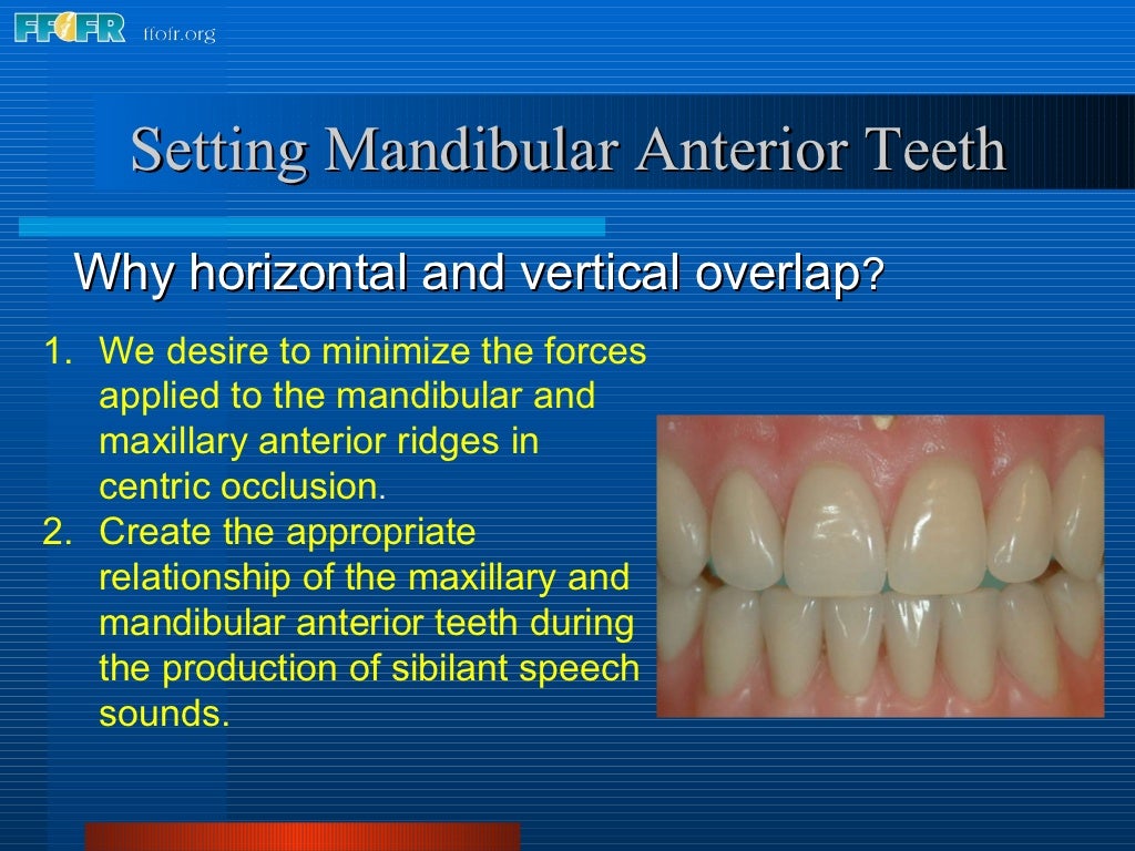 16.occlusal schemes lingualized occlusion