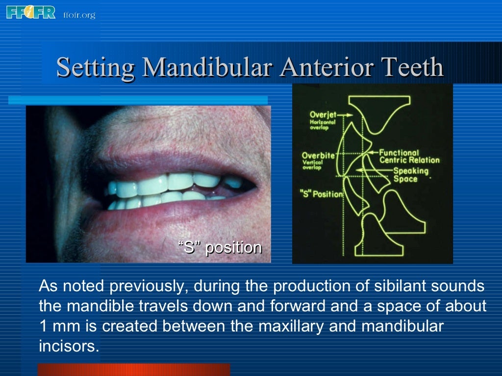 16.occlusal schemes lingualized occlusion