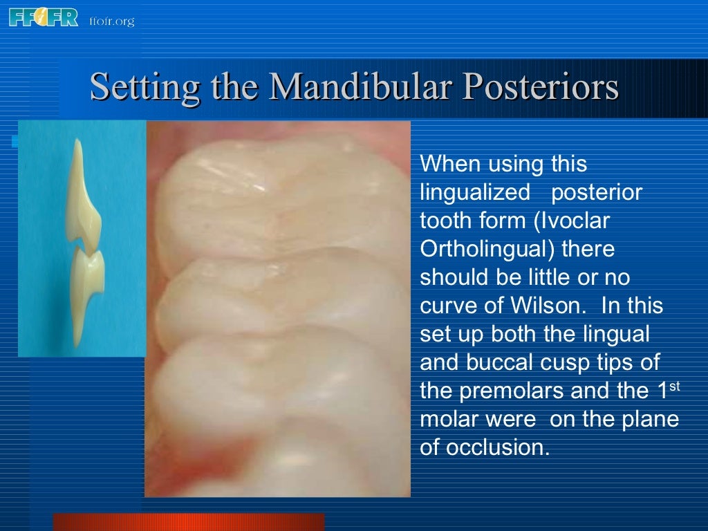 16.occlusal schemes lingualized occlusion
