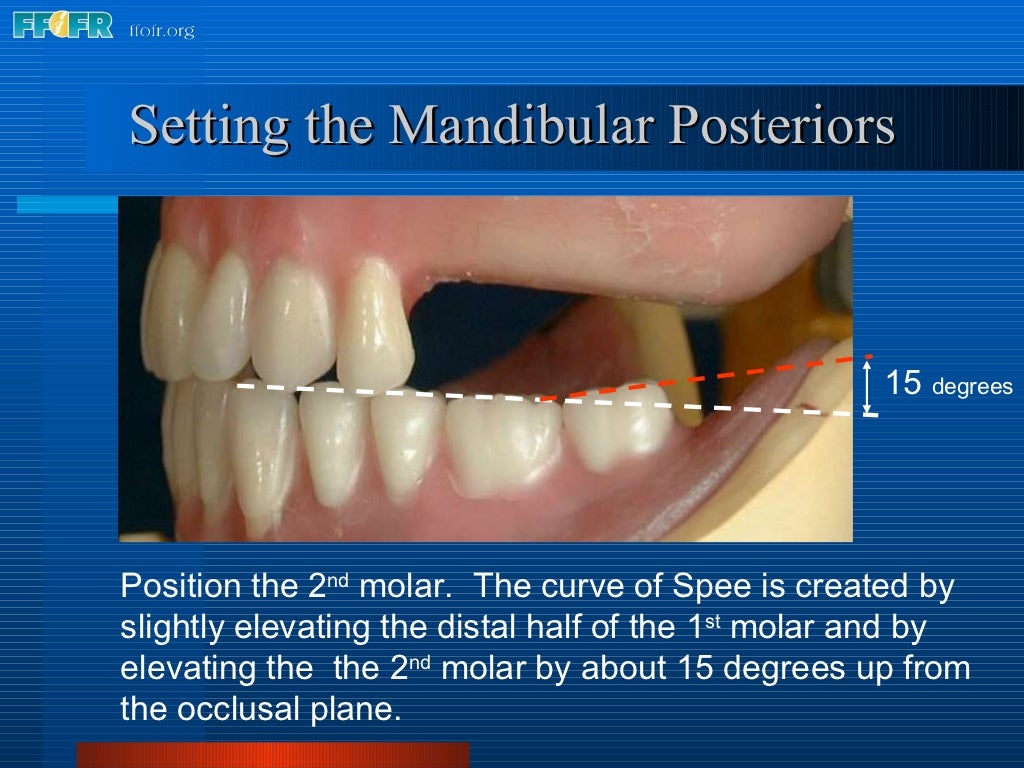 16.occlusal schemes lingualized occlusion
