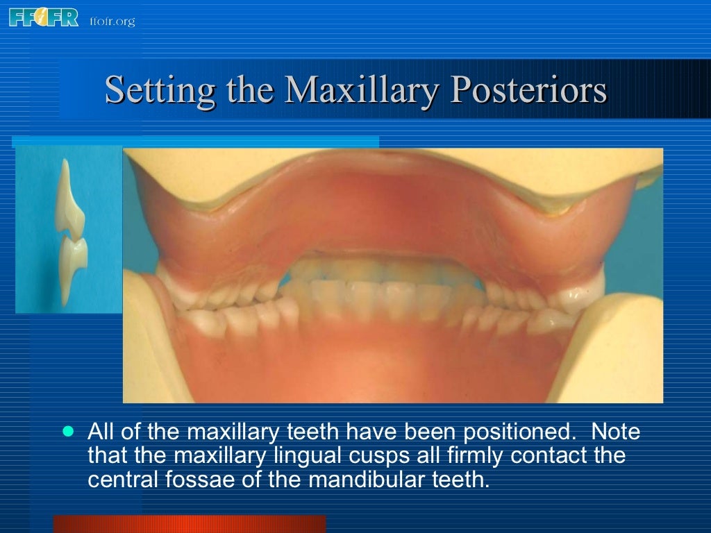 16.occlusal schemes lingualized occlusion